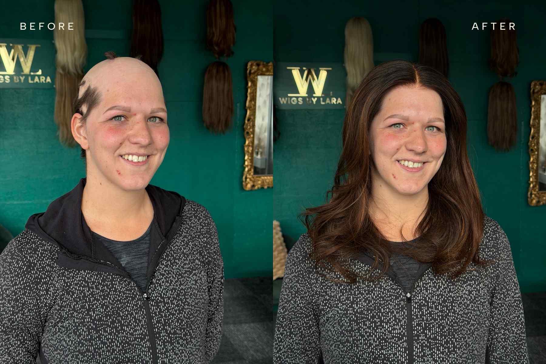 Echte voor- en nafoto van een klant met alopecia en haar persoonlijke haarwerk